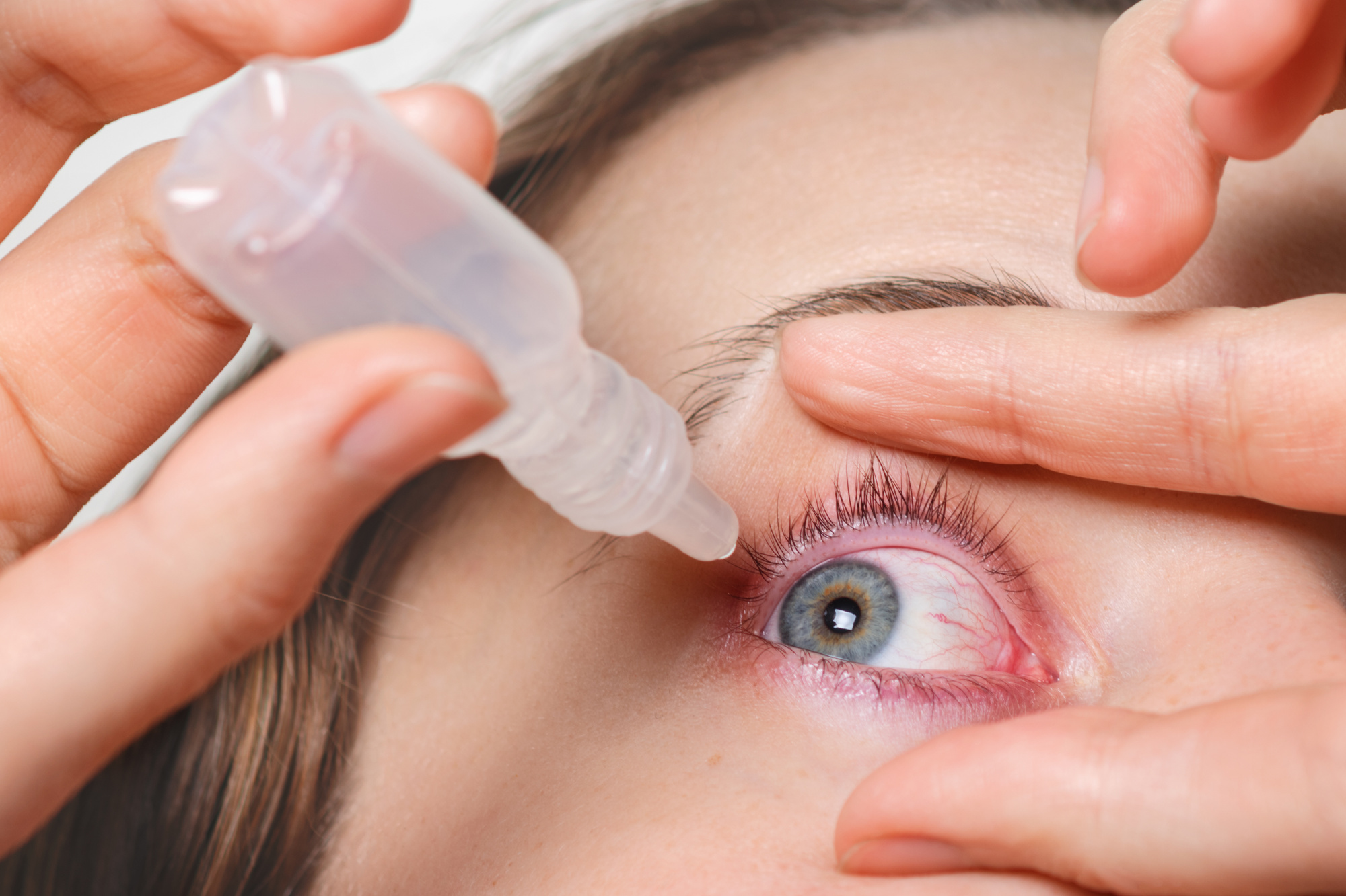 Sydney Eye Clinic: Eye Drop Misuse is Affecting the Sight of Many Australians